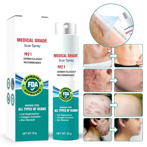 🔥Advanced Scar Spray For All Types of Scars🔥 - For example Acne Scars, Surgical Scars and Stretch Marks ⚡️⚡️⚡️