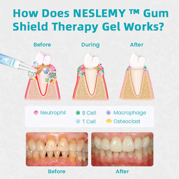 🔥Last Day Promotion 70% OFF🔥--NESLEMY™ Gum Shield Therapy Gel